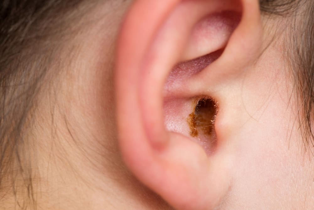 A close up of an ear with a bug in it